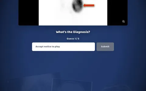 'Radiordle' game in progress