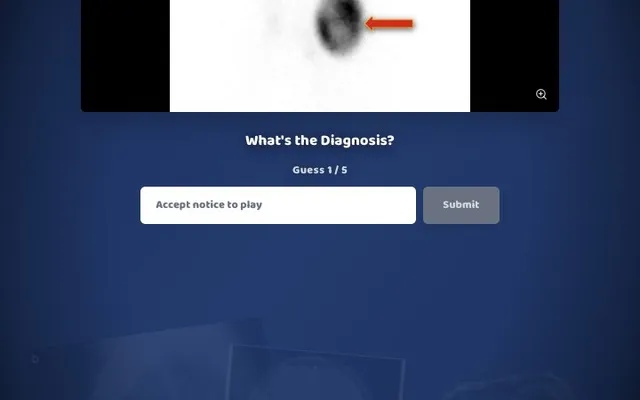 'Radiordle' game in progress